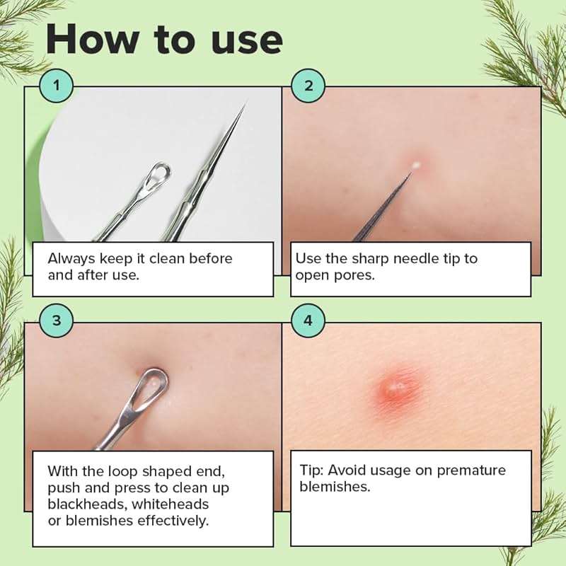 I DEW CARE Dual-Tip Pimple Tool - Proper Popper | Blackhead Remover, Blemish Exfoliating, Professional Acne Squeezer, Comedone Zit Extractor for Women, 2in1 Stainless Steel Lancet, 1ea - Image 3