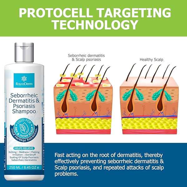 Roycederm Seborrheic Dermatitis & Psoriasis Shampoo for Dandruff - Helps Relieve Itching, Flaking & Scaling, Dry Itchy Scalp - Image 4