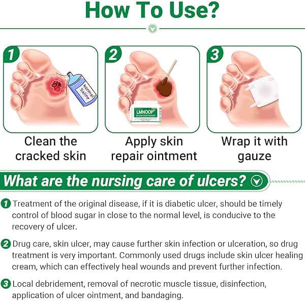 LMNOOP® Skin Ulcer Healing Ointment, for Foot & Leg Ulcers, Sores, Varicose Ulcers, Stasis Ulcers, Bedsores, Cuts, Burns, Skin Infections, Natural Ingredients Deep Wound Healing Ointment - Image 6