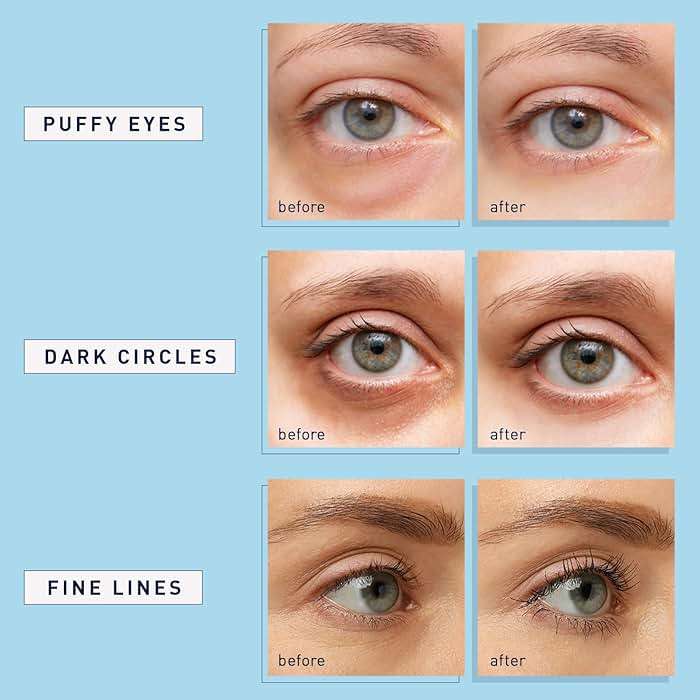 Under Eye Patches for Dark Circles: 30 Pairs Enaskin Naturals Retinol Collagen Eye Gels Mask - Reduce Wrinkles Puffy & Bags - Skin Treatment Pads - Anti Aging Moisturizer For Women (Blue) - Image 4