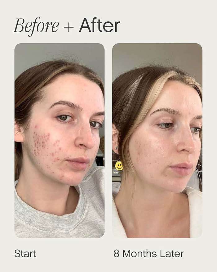 Topicals Faded Brightening and Clearing Serum | Reduces Discoloration Post-Blemish Marks Scars Spots Contains Kojic Acid Niacinamide Dermatologist-tested Vegan Cruelty-Free Fl Oz - Image 4