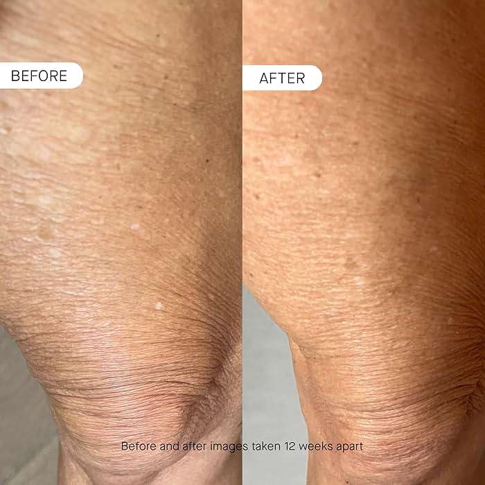 OneSkin BODY OS-01 Peptide Topical Supplement & Skin Longevity Age Reversal Moisturizer | Safe for Sensitive Skin, Fragrance-Free, 250 mL / 8.45 oz - Image 4