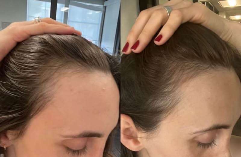 BUR BUR Growing Season Hair Growth And Repair Oil | With Burdock, Nettle Oil and Vitamin C for Visibly Fuller, Stronger and Shinier Hair. - Image 8
