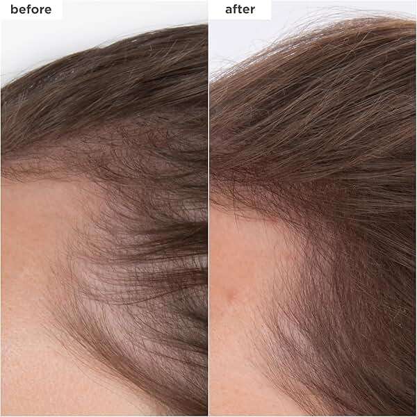 Briogeo Destined for Density Caffeine + Biotin Peptide Density Serum | Increases Hair Thickness & Volume for Fine or Thinning Hair | Fast-Absorbing & Non-Greasy | Fragrance-Free | Vegan & Cruelty-Free - Image 2