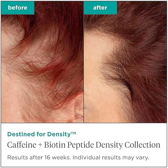 Briogeo Destined for Density Caffeine + Biotin Peptide Density Shampoo | Increases Hair Thickness and Volume for Fine or Thinning Hair | Sulfate-Free | Vegan & Cruelty-Free - Image 4