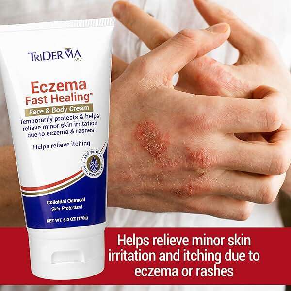 TriDerma Eczema Cream Fast Healing Eczema Relief for Face and Body, 6.0 Ounce Tube - Image 2