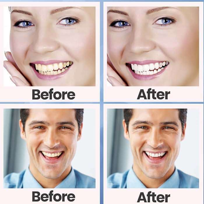 Teeth Whitening Strips, 28 Pcs Whitening Strips for Teeth Sensitive, Effective and Safe Whiting Stripes Reduced Sensitivity White-Strips, Helps Remove Smoking/Coffee/Soda/Wine Stain (14 Treatments) - Image 9