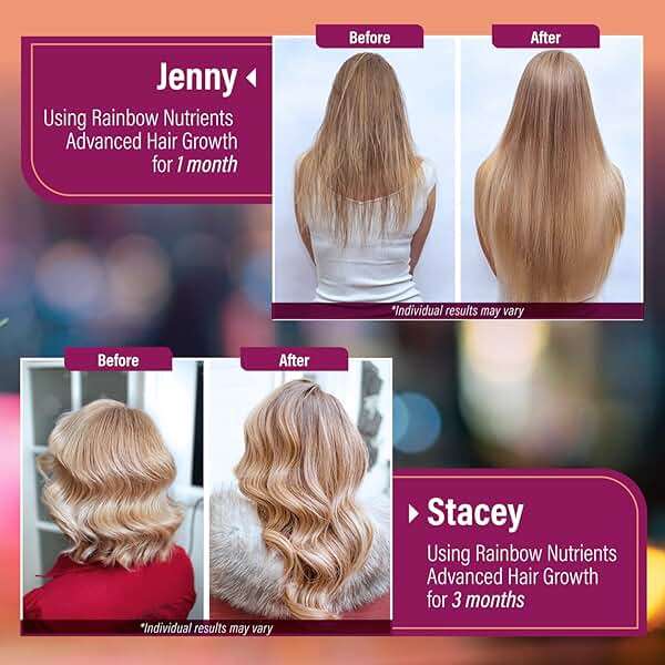 Hair Growth Vitamins for Women | Biotin 10,000mcg, Collagen, Patented OptiMSM®, goMCT®, Saw Palmetto | Naturally Regrow Stronger & Healthier Hair, Skin and Nails | Natural & Made in USA |60 Day Supply - Image 6