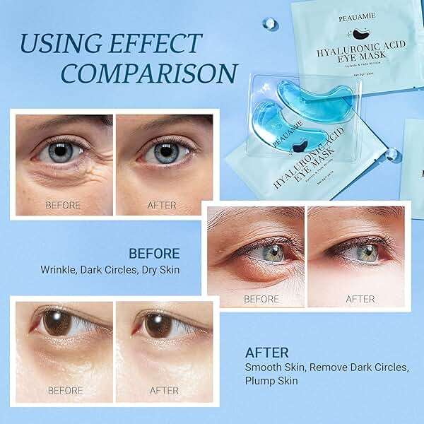 PEAUAMIE Under Eye Patchs Hyaluronic Acid Eye Mask for Dark Circles and Puffiness Wrinkle Eye Bags 30 Pairs - Image 4