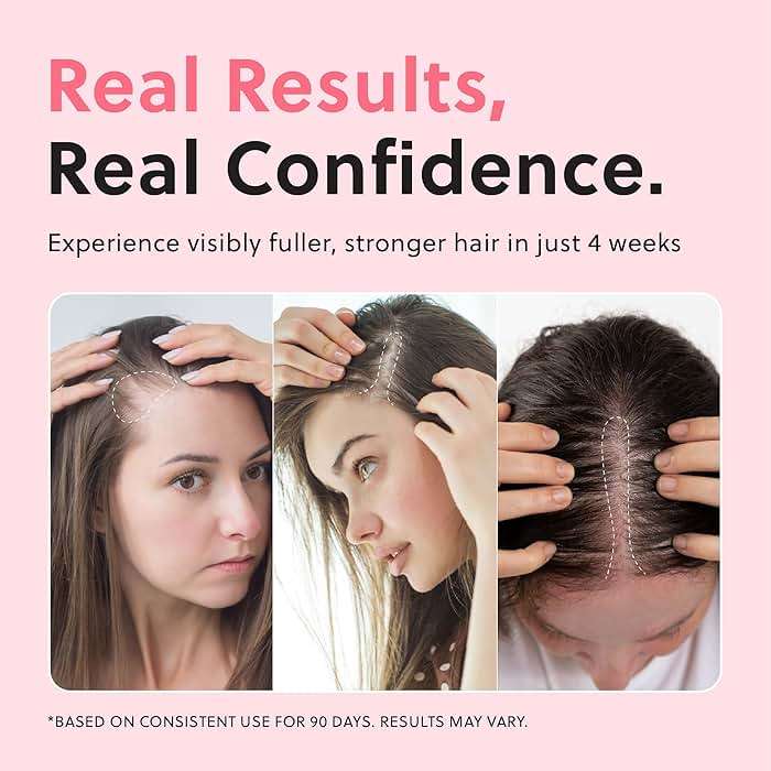 ForChics Hair Growth Serum for Women- Results in 4 Weeks- Hormone Free Hair Regrowth Treatment - For Thinning Hair Loss - Fast Absorbing Non-Greasy Scalp Spray 50ml - Image 3
