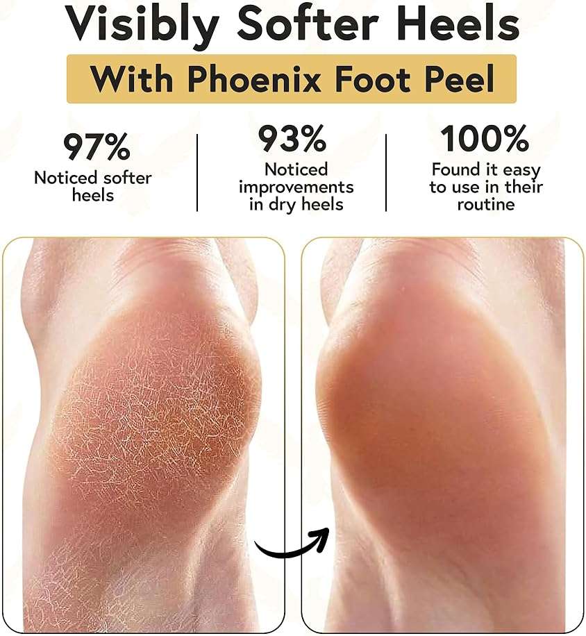 Phoenix Foot Peel Moisturizing Gel Socks for Men - Extra Large 2 Pairs - Silicone Heel Socks, Cracked Heel Treatment, Reusable Spa Socks with Shea Butter for Dry Skin & Foot Care - Image 2