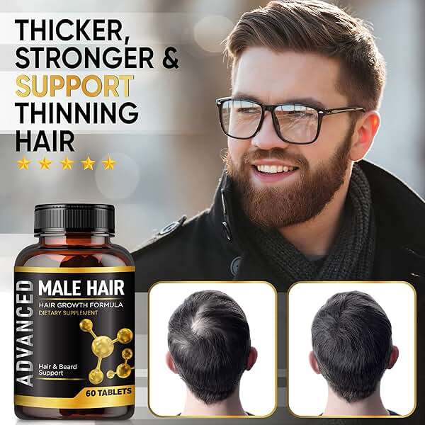 Hair Growth Vitamins For Men-Anti Hair Loss Support Vitamins Pills & Dht Blocker For Men.Regrow Hair & Beard Growth Supplement For Thicker Fuller & Stronger Hair. Support Thinning Hair With Biotin. - Image 2