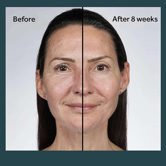 No7 Future Renew Damage Reversal Night Cream - Anti Aging Face Moisturizer - Infused with Peptide Technology to Reverse Visible Signs of Damage - Skin Barrier Repair for Dry Skin (1.69 Oz) - Image 5