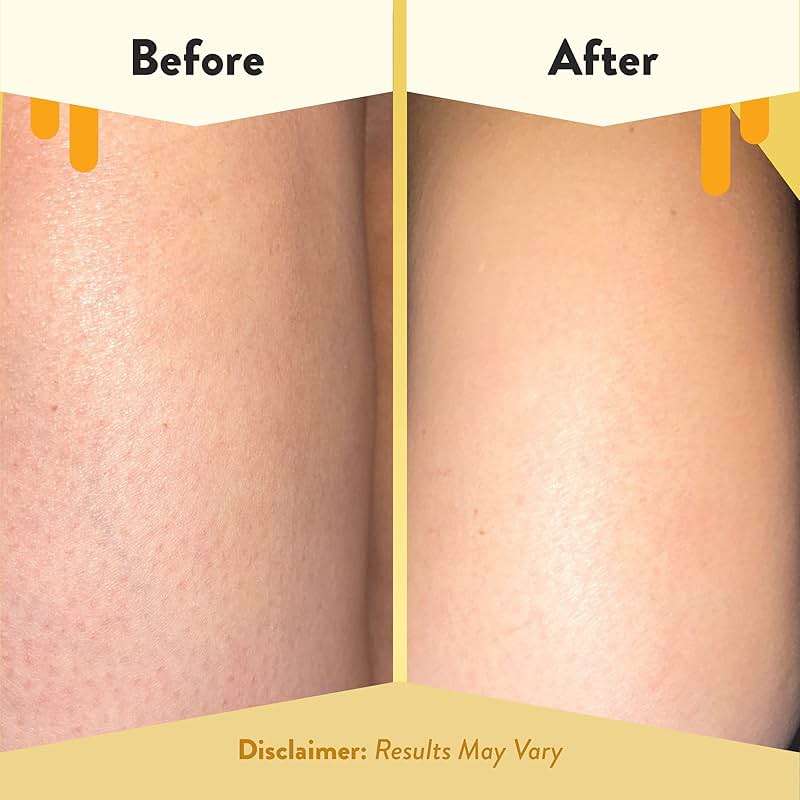 ECZEMA HONEY Soothing Body Wash - Daily Shower Gel & Eczema Treatment - Sensitive Skin Body Wash for Adults, Kids, & Babies - Body Cleanser for Eczema Relief (13 Oz) - Image 4