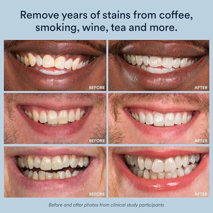 Auraglow Teeth Whitening Gel for Toothpaste, 9% Hydrogen Peroxide, Add to Toothpaste to Whiten, 350+ Whitening Treatments, Removes Coffee Wine Tea Stains, No Trays or Strips, Made in USA, 2.6oz - Image 5