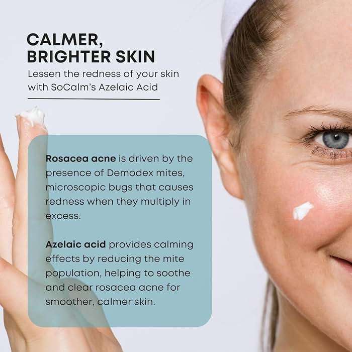 SoCalm Azelaic Acid 10% for Rosacea-Prone Skin – Calms Face Redness & Evens Tone, with Niacinamide & Ceramide NP, Fragrance-Free, 30ml / 1oz - Image 2