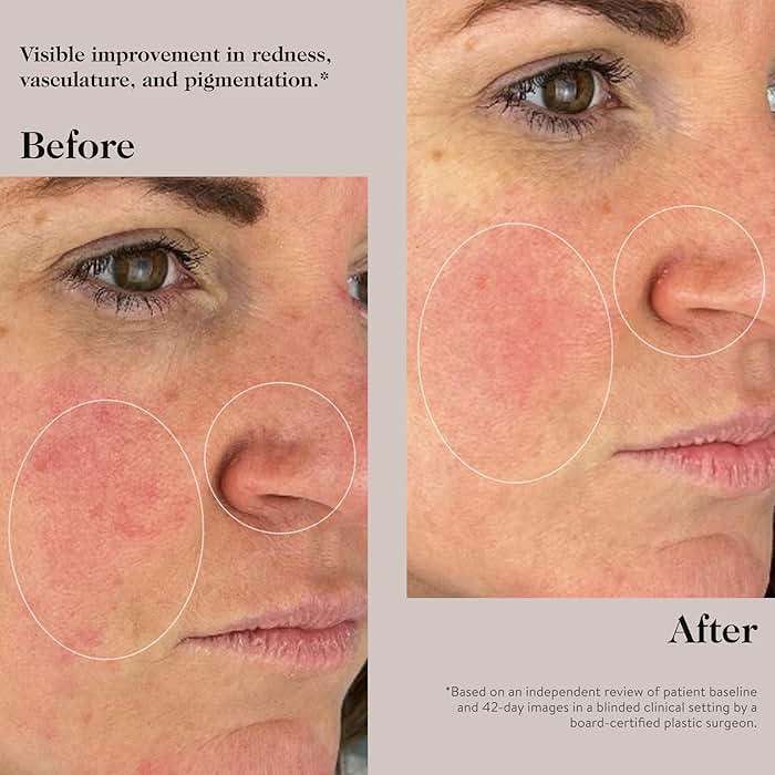 goop Beauty Peptide Serum | Reduces Fine Lines & Wrinkles | Peptides, Ceramides, & Niacinamide | Anti Aging Serum to Improve Firmness & Elasticity | Paraben Free | 1 fl oz - Image 6