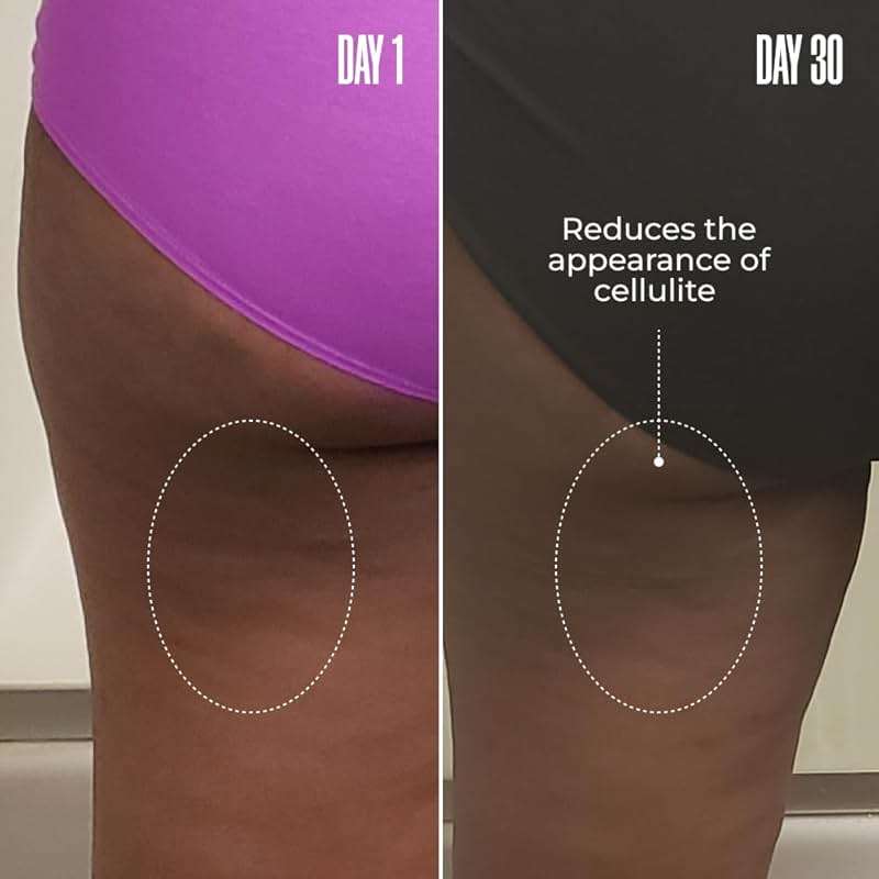 MAËLYS RE-LURE Tight & Tone Body Serum - Helps Reduce the Look of Cellulite - Skin Tightening with Hyaluronic Acid - Firming for Stomach, Thighs & Arms - Lightweight Body Firming Serum (3.5 Fl Oz) - Image 3