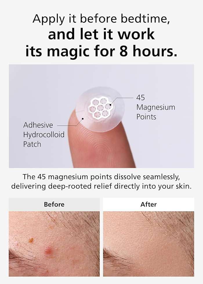 EasyDerm Quick Calming Magnesium Pimple Patches – Acne Spot Treatment with Tweezers & Ampoule, 10 Patches, Zit Sticker, Daewoong Pharmaceutical, Summer Season Travel Essentials - Image 7