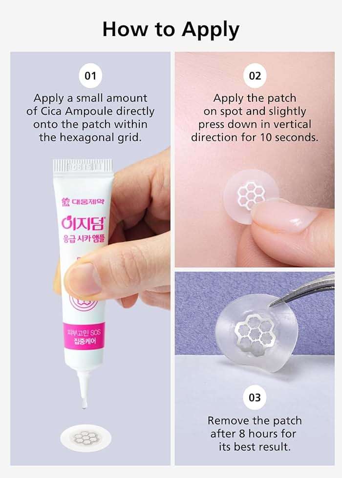 EasyDerm Quick Calming Magnesium Pimple Patches – Acne Spot Treatment with Tweezers & Ampoule, 10 Patches, Zit Sticker, Daewoong Pharmaceutical, Summer Season Travel Essentials - Image 8