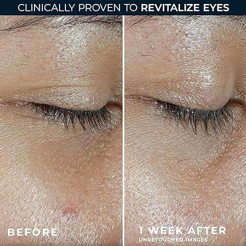 RoC Multi Correxion Revive + Glow Eye Balm with Vitamin C (0.14 oz) + Retinol Eye Cream Packette - Image 4