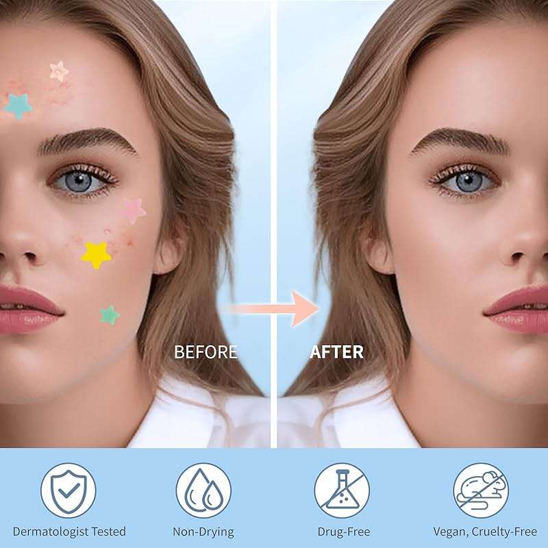 QUSTERE Pimple Patches for Face, Hydrocolloid Acne Patches, Cute Star Zit Covers, Colorful Spot Stickers with Tea Tree, Salicylic Acid & Cica Oil| 3 Sizes (10mm, 12mm & 14mm) |200 Count - Image 4