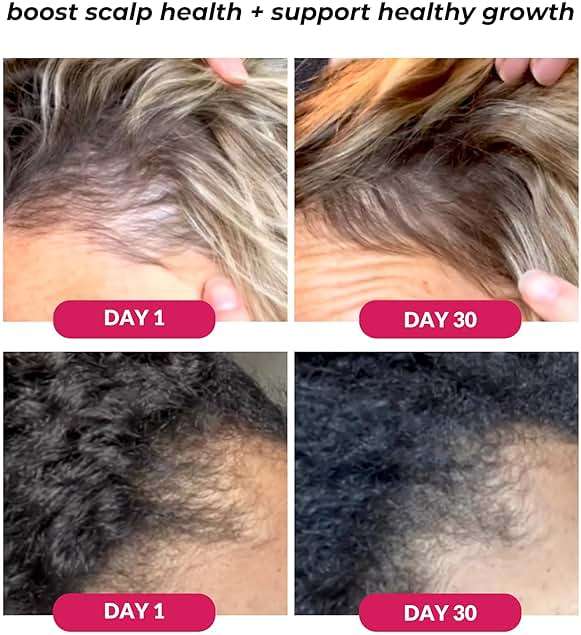 Love Ur Curls - Healthy Scalp Serum Growth Hair Activator, Turmeric & Basil Extracts for Deep Moisturizing and Thicker Full Hair, Vegan, 50mL - Image 3