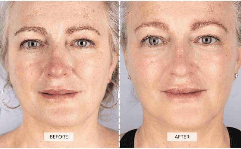 CurrentBody Skin LED Light Therapy Face Mask: Series 1 | Red Light Therapy Treatment Device | Anti-Aging Face Mask for Wrinkle Reduction - Image 3