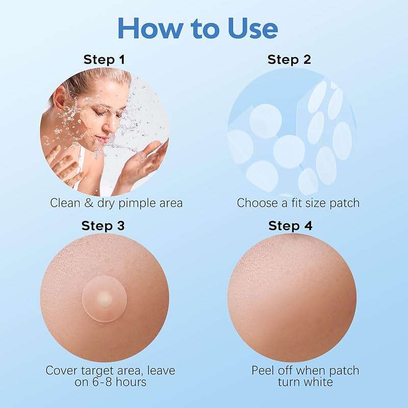 Pimple Patches for Face & Body,331 Patches Variety Pack w/ Large Sizes,Invisible Hydrocolloid Acne Patch with Tea Tree Oil & Salicylic Acid,Overnight Zit Stickers for Blemishes & Spots, All Skin Types - Image 7