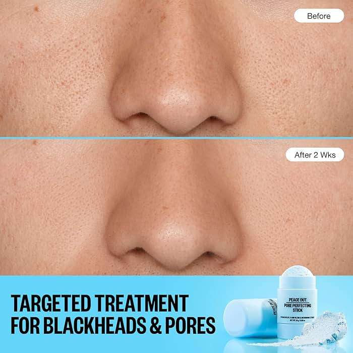 PEACE OUT Pore Perfecting Stick With Kaolin Clay to Clear Clogged Pores, Exfoliating Face Cleanser with Glycolic and Salicylic Acids, Draw Out Dirt & Oil (0.53 oz) - Image 3