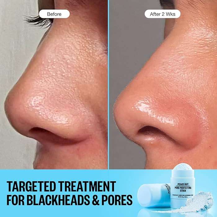 PEACE OUT Pore Perfecting Stick With Kaolin Clay to Clear Clogged Pores, Exfoliating Face Cleanser with Glycolic and Salicylic Acids, Draw Out Dirt & Oil (0.53 oz) - Image 9