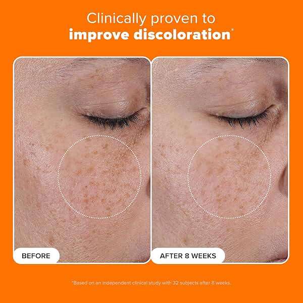 Paula’s Choice 25% Vitamin C Serum with Glutathione & Antioxidants, Face Serum Improves Discoloration, Uneven Tone & Firms, All Skin Types, Fragrance-Free, 1oz - Image 4