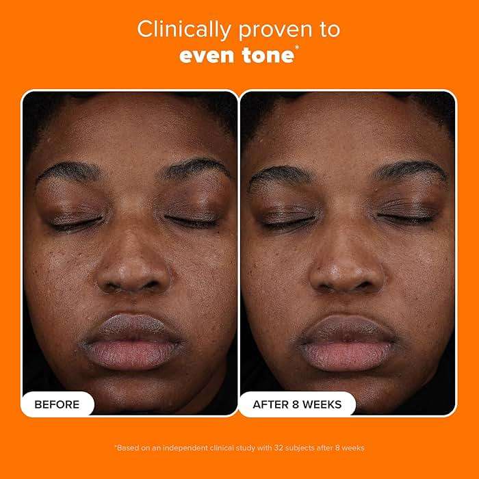 Paula’s Choice 25% Vitamin C Serum with Glutathione & Antioxidants, Face Serum Improves Discoloration, Uneven Tone & Firms, All Skin Types, Fragrance-Free, 1oz - Image 5