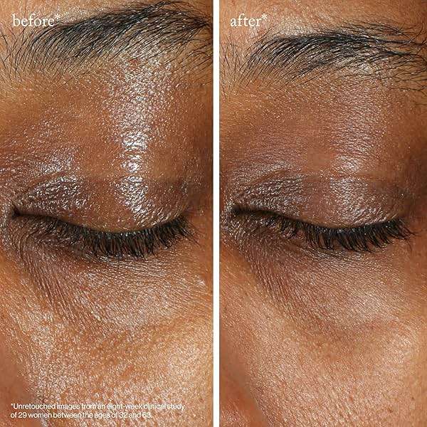 goop Beauty Vitamin C Eye Cream | Color Correcting Cream for Dark Circles | Helps Smooth Wrinkles & Depuff Eyes | 0.5 fl oz - Image 7