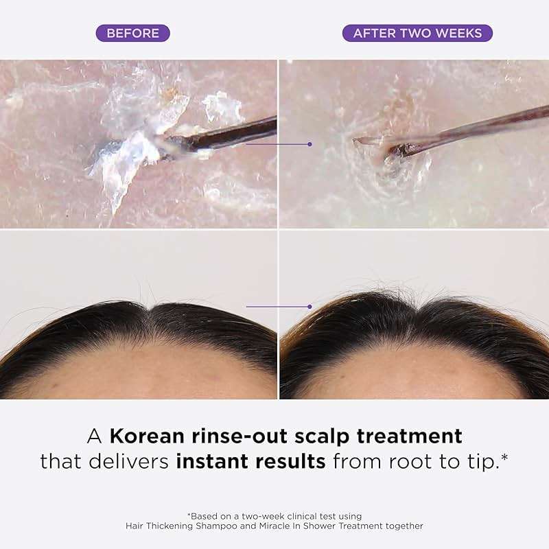 Dr. Groot Miracle in Shower Moisturizing Treatment for Hair Loss, Korean Hair Care Rinse, Rosemary Oil for Smooth, Healthier-Looking Hair in 5 Seconds, Scalp Revitalizing Solution - Image 2
