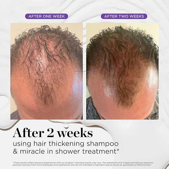 Dr. Groot Miracle in Shower Moisturizing Treatment for Hair Loss, Korean Hair Care Rinse, Rosemary Oil for Smooth, Healthier-Looking Hair in 5 Seconds, Scalp Revitalizing Solution - Image 8