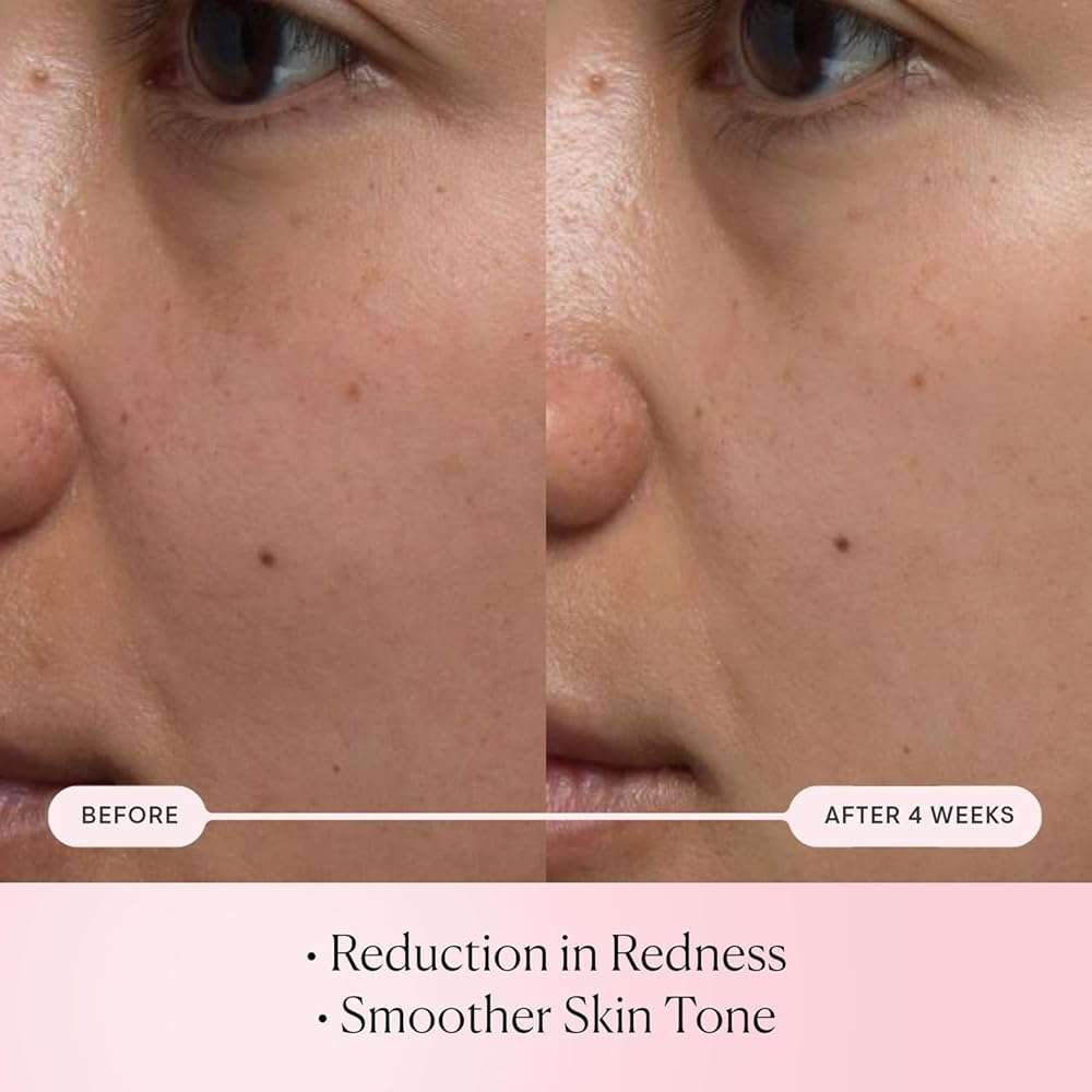 ELEMIS Pro-Collagen Rose Micro Serum | Hydration serum that plumps, soothes, and nourishes your skin while reducing fine lines & wrinkles. - Image 3