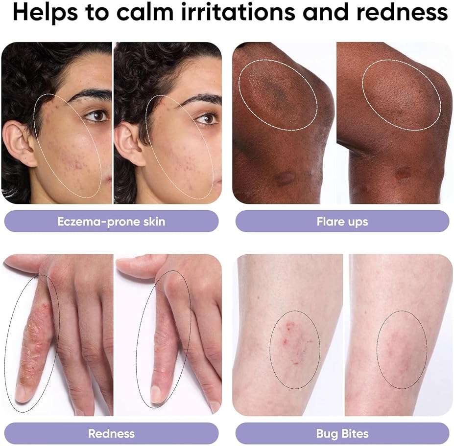 QIQ Skin Savior – High Purity Hypochlorous Acid to Cleanse and Tone Skin, Alcohol-Free, Irritant-Free, Facial Spray to Help Prevent Breakouts, Reduce Redness & Calm Irritation (5oz) - Image 3