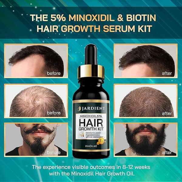 Minoxidil and Biotin Hair Growth Oil for Beards and Preventing Hair Thinning - 5% Minoxidil for Men and Women, 1 Fl Oz - Image 3