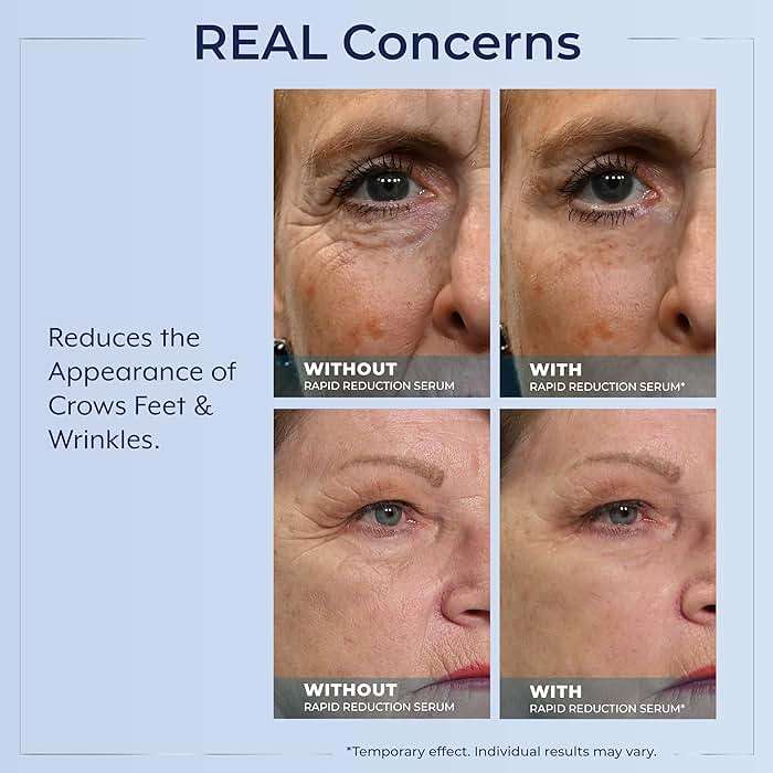 Plexaderm Rapid Reduction Eye Serum - Visibly Reduces Under-Eye Bags, Wrinkles, Dark Circles, Fine Lines & Crow's Feet Instantly, Anti Aging Wrinkle Remover for Face, Full Size Tube - Image 5