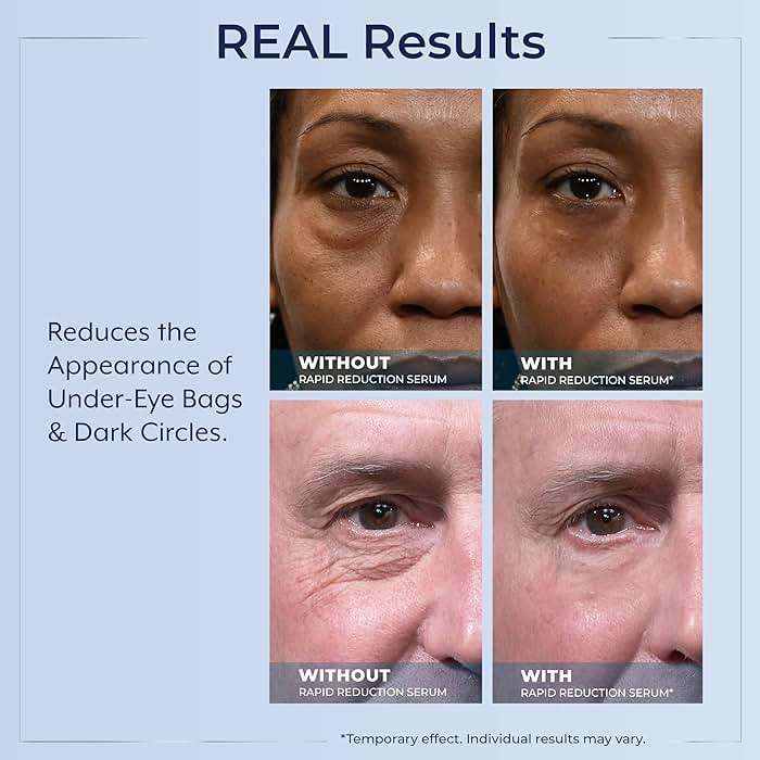 Plexaderm Rapid Reduction Eye Serum - Visibly Reduces Under-Eye Bags, Wrinkles, Dark Circles, Fine Lines & Crow's Feet Instantly, Anti Aging Wrinkle Remover for Face, Full Size Tube - Image 6