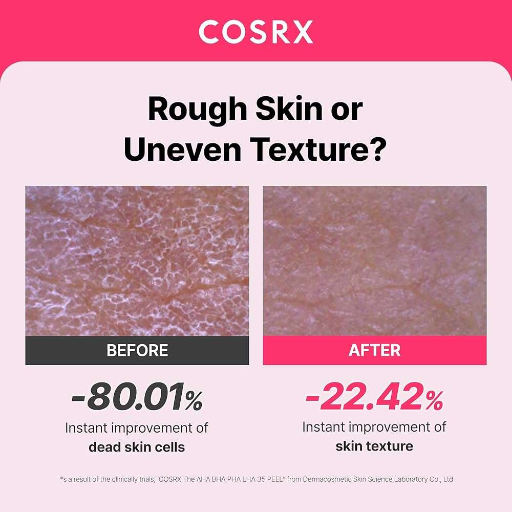 COSRX AHA BHA PHA LHA 35% Peel 1.01 fl. oz / 30 ml, Chemical Exfoliating Peeling Gel for Dull, Rough, Oily skin with Clogged Pored & Dead Skin Cells, Highly Concentrated - Image 2