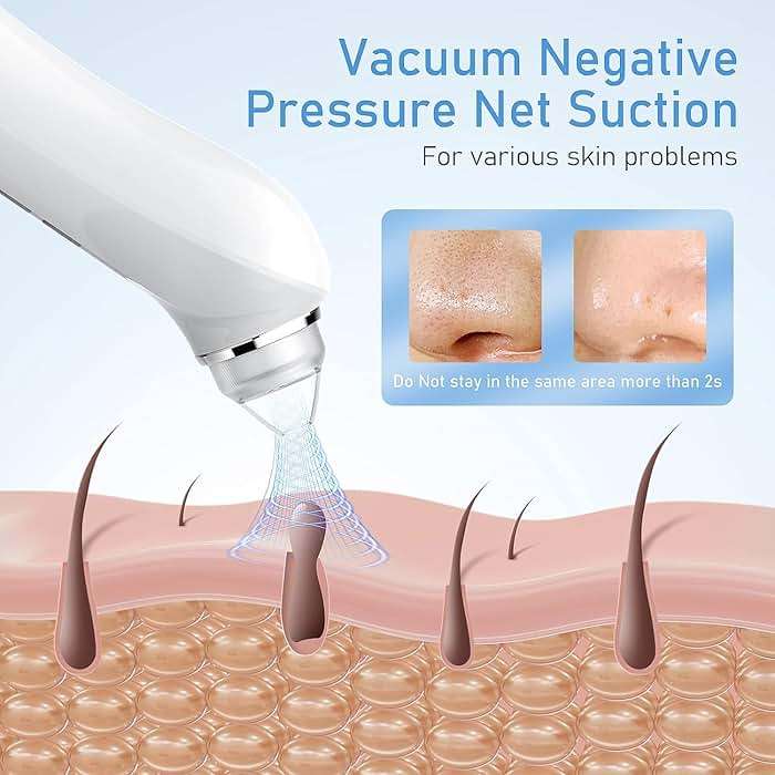 Blackhead Remover Vacuum, USB Interface Type Pore Vacuum, Black Head Extractions Tool with Camera for Men and Women Pore Cleaner, 3 Adjustment Modes & 6 Suction Heads(Light Pink) - Image 3