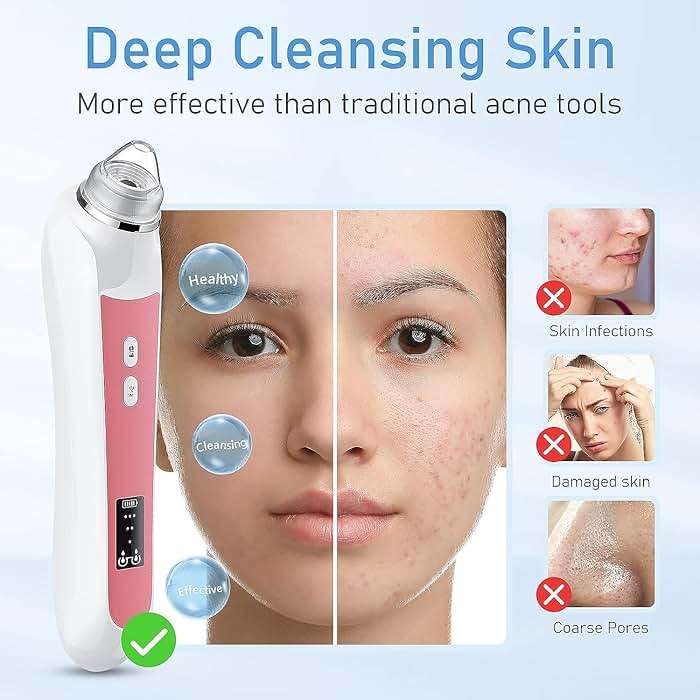 Blackhead Remover Vacuum, USB Interface Type Pore Vacuum, Black Head Extractions Tool with Camera for Men and Women Pore Cleaner, 3 Adjustment Modes & 6 Suction Heads(Light Pink) - Image 4