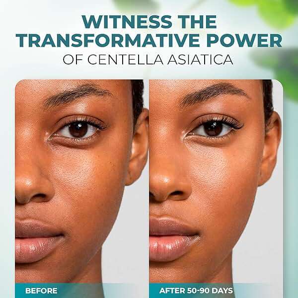 Centella Asiatica Face Serum - Natural Calming & Protecting Moisturizer with Pure Centella Extract - Niacinamide & Hyaluronic Acid Serum for Face - Image 4