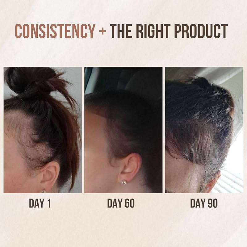 Premium Batana oil for Hair Growth |100% Raw Elaeis Oleifera for Natural Scalp Care | Dr Sebi Hair Shine treatment for Men & Women | Natural Cold Pressed Extraction Method | Liquid Formula - Image 5