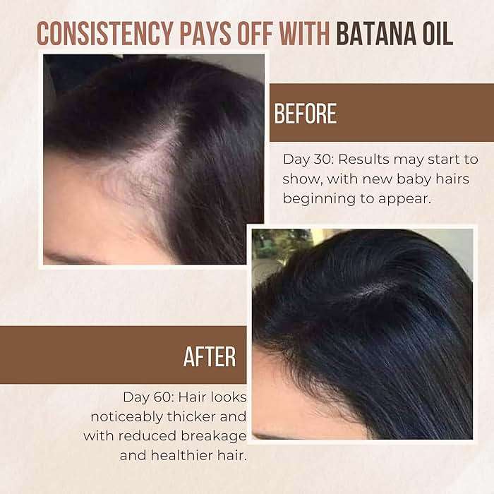 Premium Batana oil for Hair Growth |100% Raw Elaeis Oleifera for Natural Scalp Care | Dr Sebi Hair Shine treatment for Men & Women | Natural Cold Pressed Extraction Method | Liquid Formula - Image 6