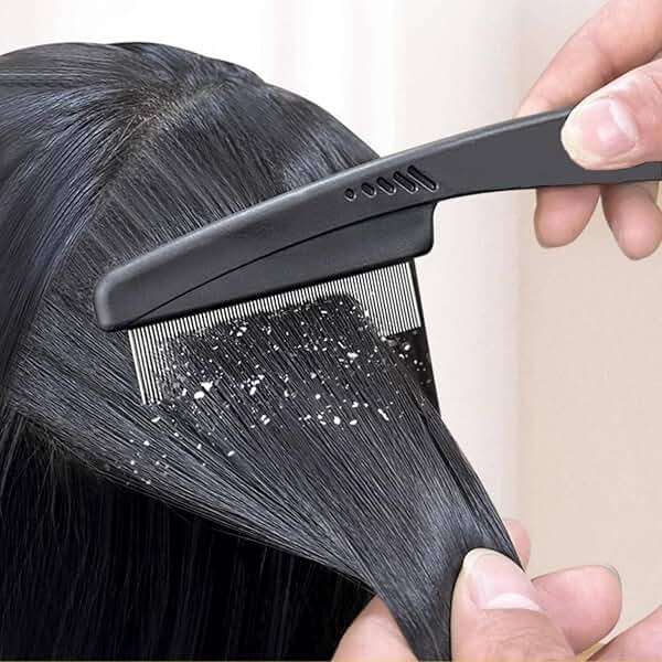 Yumflan 1.0mm Fine Tooth Stainless Steel Dandruff Comb for Adults Kids - Image 5