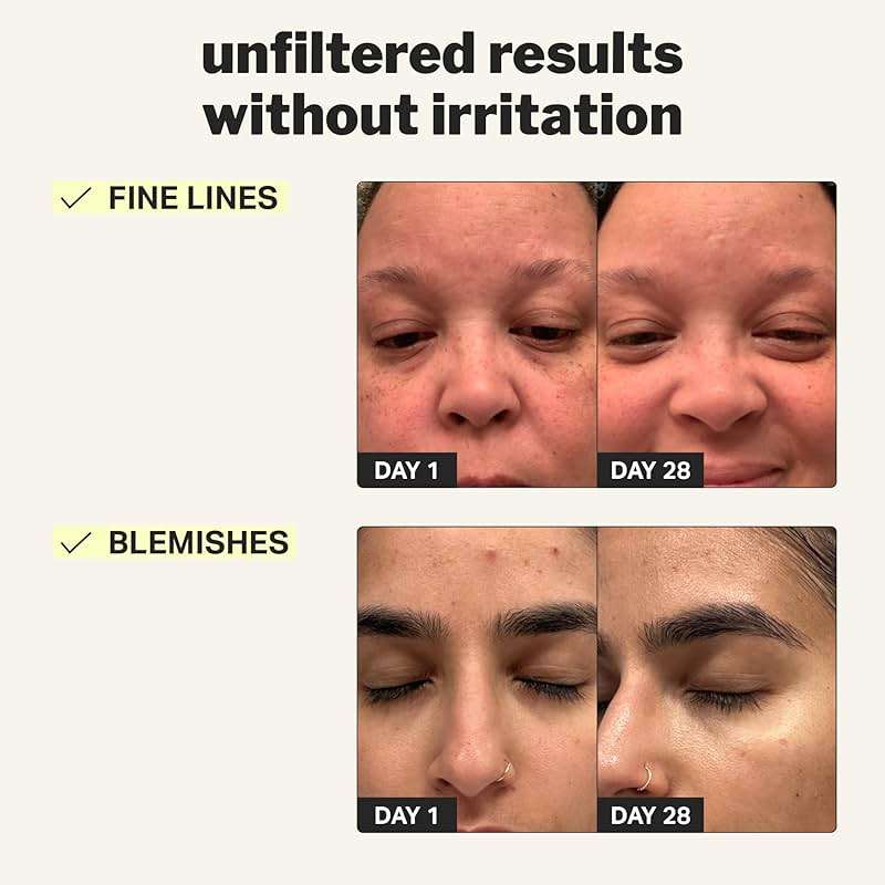 Cocokind Beginner Retinol Gel 0.1%, Improve the Appearance of Fine Lines and Uneven Texture without Irritation, Aloe and Cica to Prevent Dryness, 1 fl oz - Image 3