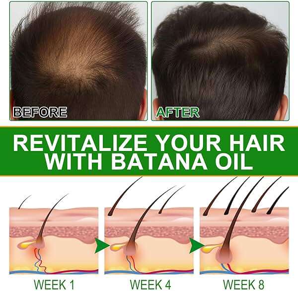 Batana Oil for Hair Growth and Nourishment - Scalp Massager Included, Honduras Pure & Natural Oil for Split Ends Elimination, Enhanced Hair and Skin Radiance, All Hair Types, 2.02 fl oz - Image 6